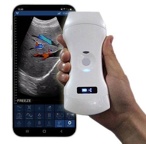 sonostar_c5pl_wireless_handheld_ultrasound_diagnostic_scanner